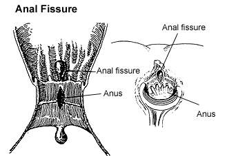 Lena xola ogziga sikiladi